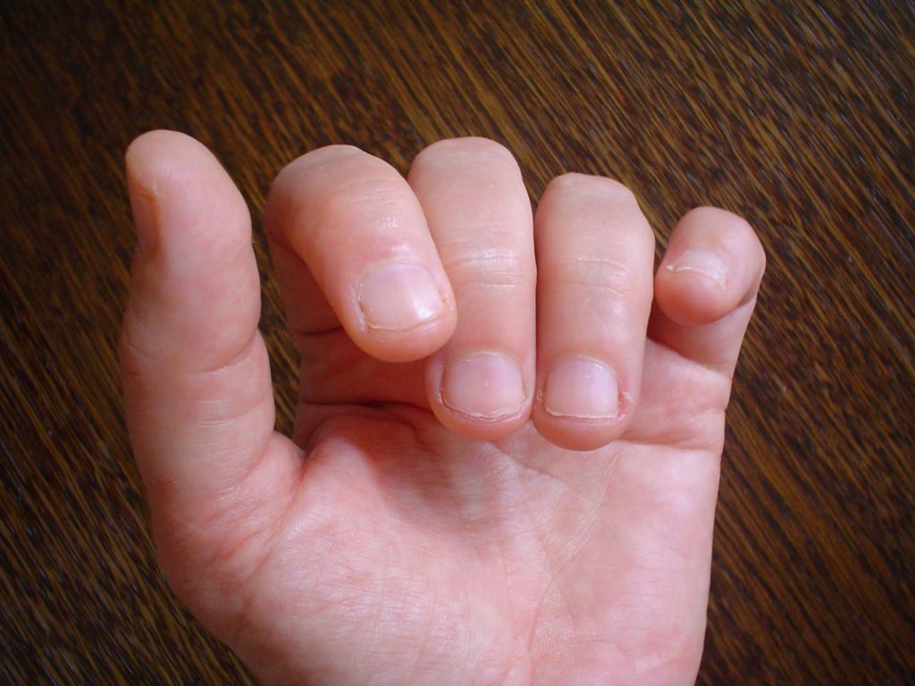 if-you-can-quit-biting-your-nails-ellistangents